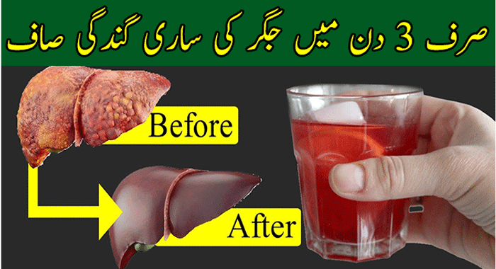 Detox and Cleanse Your Liver Naturally