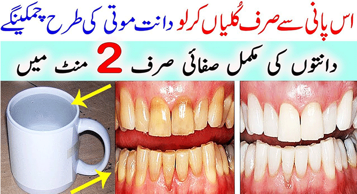 This Will Whiten Your Teeth In 2 Minutes