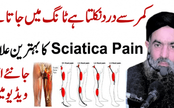 Get Rid of Sciatica and Back Pain