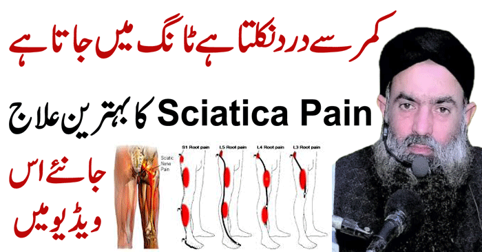 Get Rid of Sciatica and Back Pain