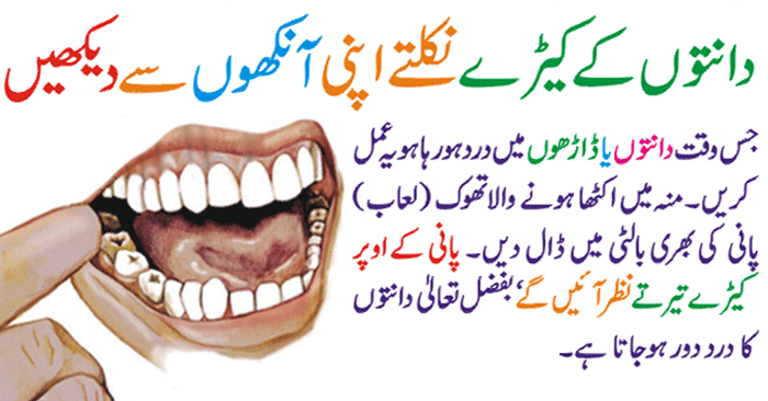 How to Prevent Dental Caries and Treatment