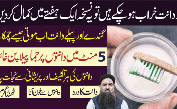 Teeth Whitening Naturally Dr Sharafat Ali
