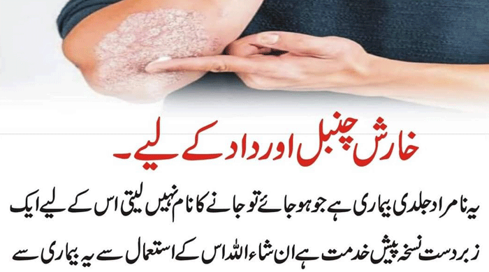 Home Remedies to Get Rid Of Itching Skin Naturally
